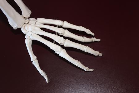 骨架, 手, 骨头, 解剖, 联合, 骨骼肌, 关节炎