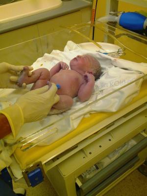 出生, 第一次呼吸, 宝贝, 送货室, 脐, 保健